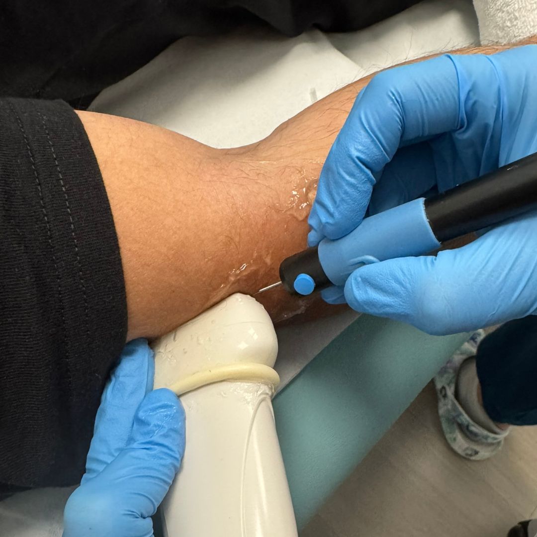 Electrólisis Percutánea Ecoguiada